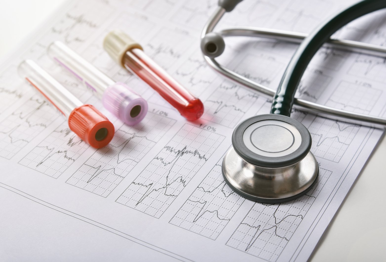 Electrocardiograma